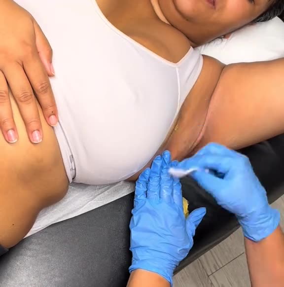 Nevada Underarm Waxing with Sexy Smooth Golden Allure Hard Wax | @Desiredskyn Professional Demo
