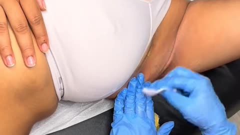 Nevada Underarm Waxing with Sexy Smooth Golden Allure Hard Wax | @Desiredskyn Professional Demo
