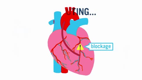 What Happens During A Heart Attack?