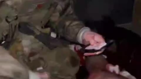 Russian Soldier Claims He Was Shot in the Legs By Drunk Soldier