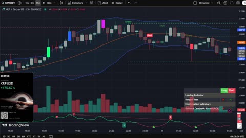 🔴LIVE XRP Moon Party 🚀 Trading Signals, Chat and News