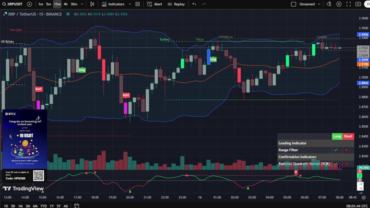 🔴LIVE XRP Moon Party 🚀 Trading Signals, Chat and News