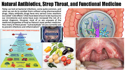 Natural Antibiotics, Strep Throat, and Functional Medicine
