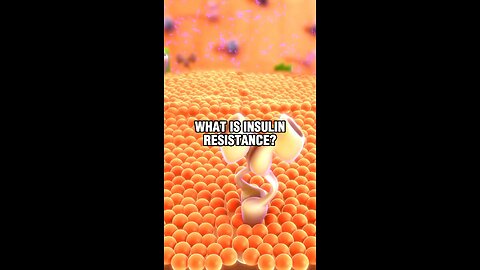 Insulin resistance