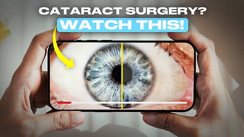 Things You NEED To Know About Cataract Surgery