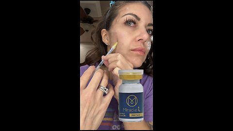 Round 4 Miracle L Liquid PCL Treatment