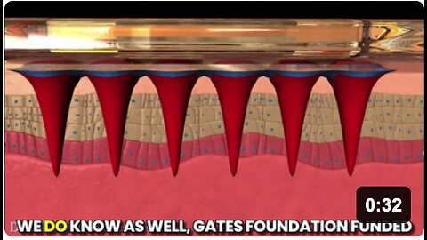 COMING SOON: The Gates Foundation developed microneedle patch implants