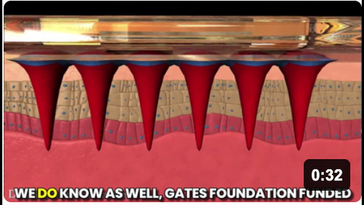 COMING SOON: The Gates Foundation developed microneedle patch implants