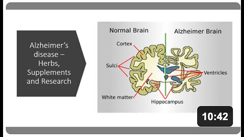 Alzheimer's Disease Natural Treatment