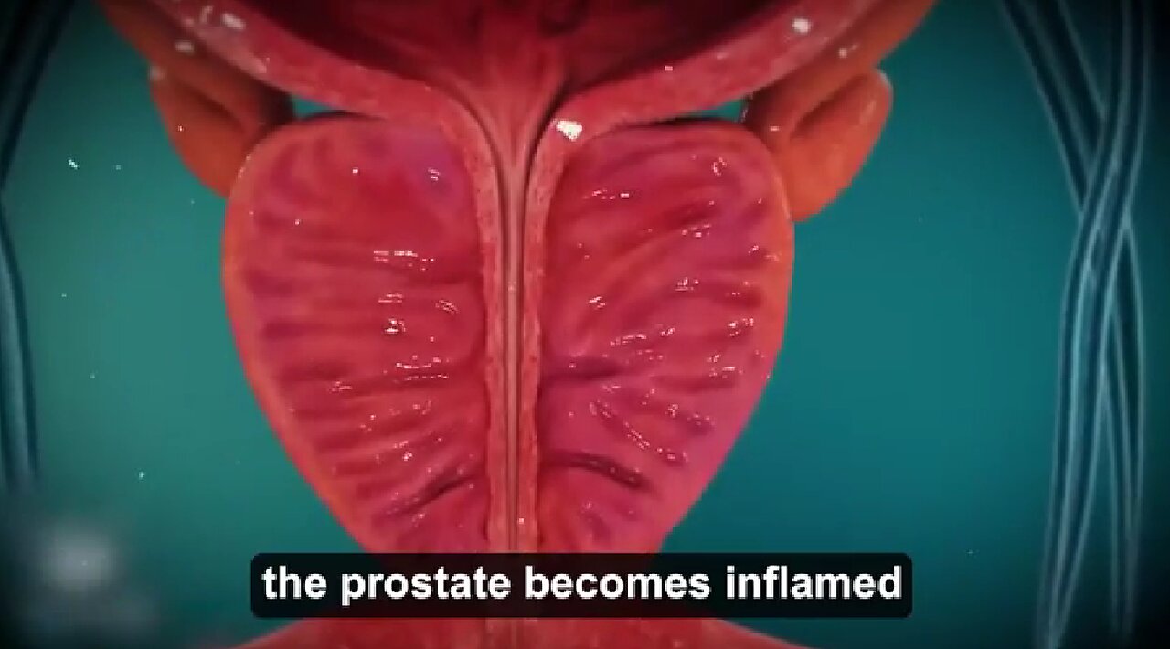 How To Reduce Enlarged Prostates Without Surgery