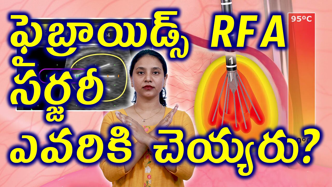 ఫైబ్రాయిడ్స్ RFA సర్జరీ ఎవరికి చెయ్యరు? Fibroids Removal Surgery Radio Frequency Ablation Warnings