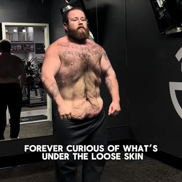 An amazing weight loss