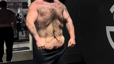 An amazing weight loss