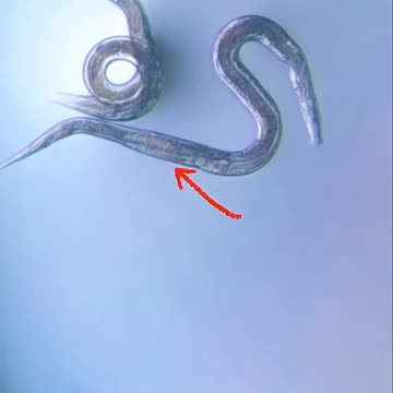 Pineapple juice VS human parasites!!!