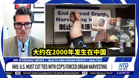 2025.09.19 CCP organ transplant system