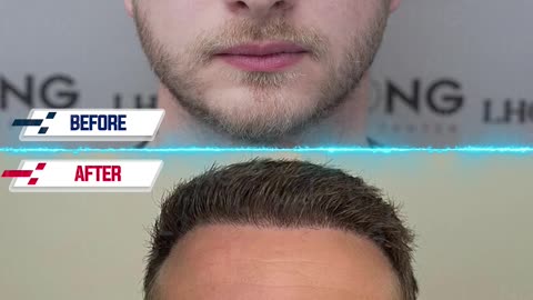 Take a look at this before-and-after result as an example.