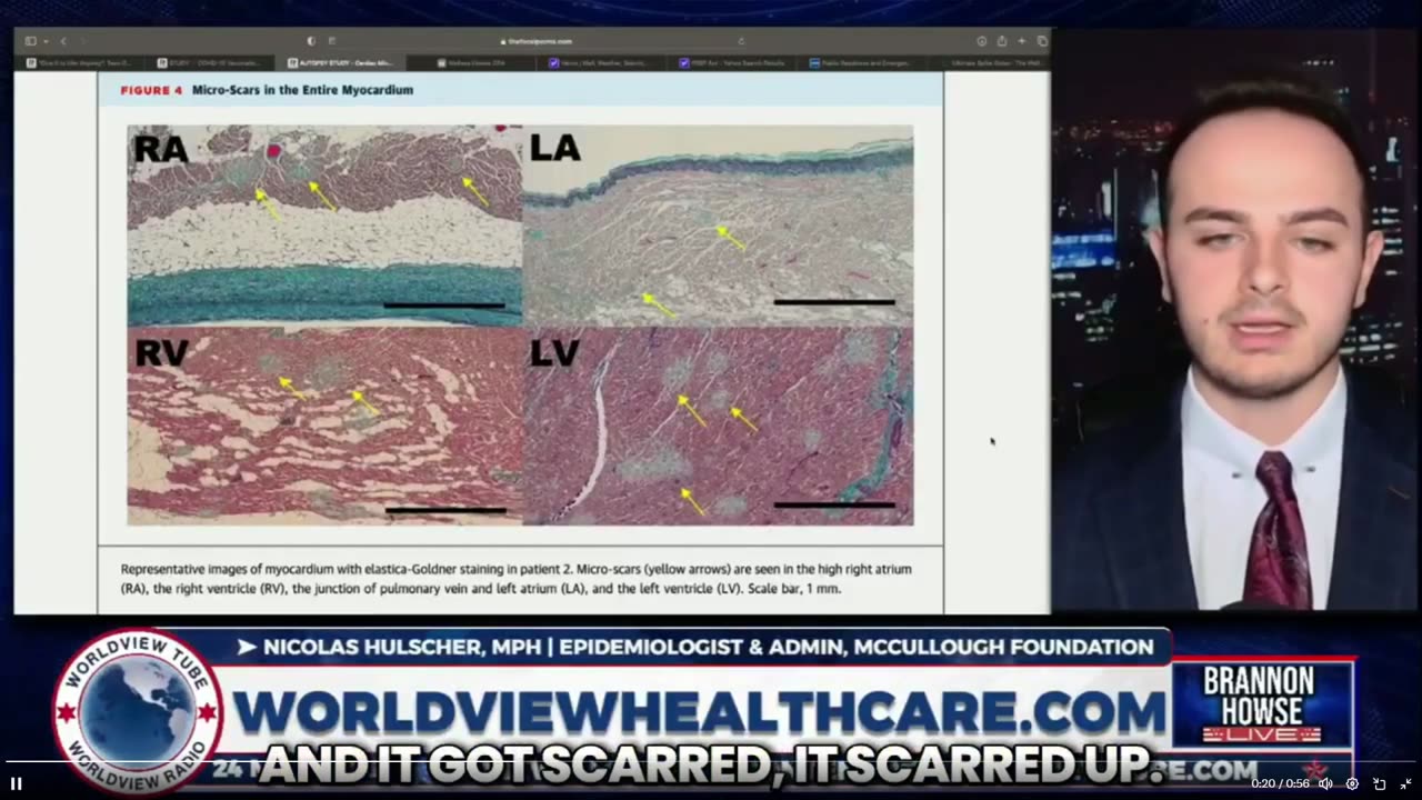 This is what the human heart looks like after five COVID-19 mRNA booster shots