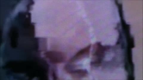 World Stage: Transgender Reptilian Shapeshifter Susan Atkins