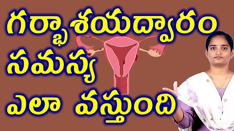 గర్భాశయద్వారం సమస్య ఎలా వస్తుంది How To Impact On Cervical Factors Infertility Homeopathy Traetment
