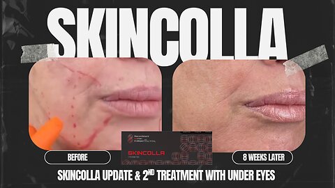 SkinColla UPDATE - Adding Under Eye Treatment in Round 2