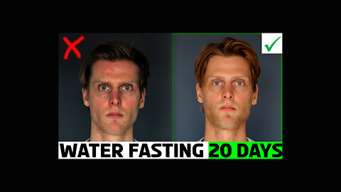 Water fast for 20 days