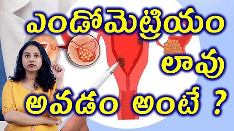 ఎండోమెట్రియం లావు పెరగడం అంటే? What is Endometrial Hyperplacia PCOS Homeopathy
