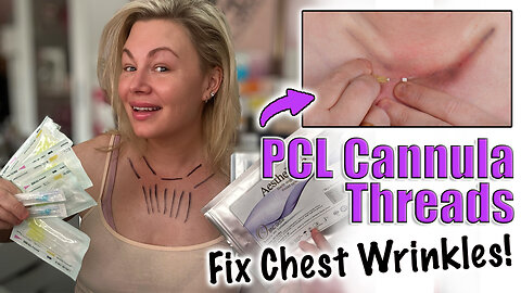 PCL Cannula Threads to Prevent Chest Wrinkles! AceCosm.com and code Jessica10 Saves