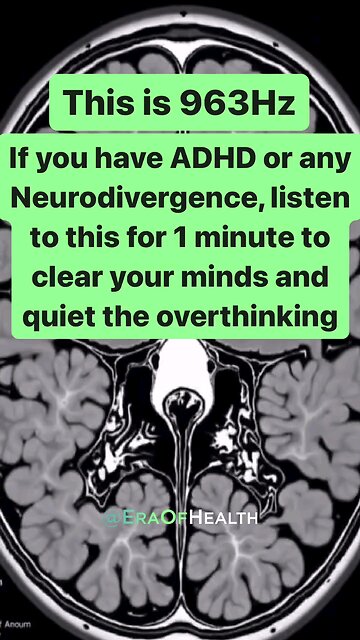Stop ADHD overthinking Listen 1 minute Frequency 963 HZ