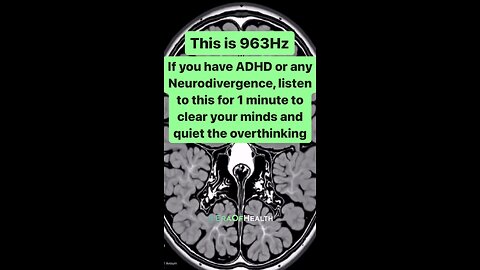 Stop ADHD overthinking Listen 1 minute Frequency 963 HZ