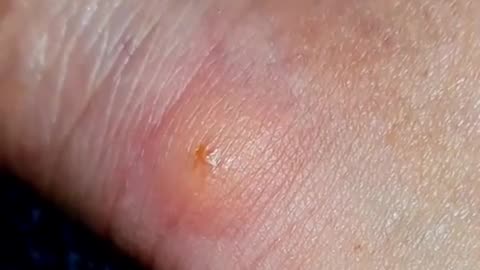 🤯✨ Watch This Spider Bite Change Color With The Pulse! | FeedMyCuriosity