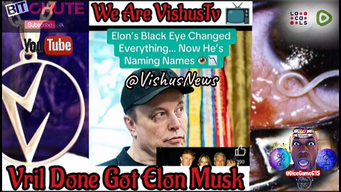 Elon 's Black 👁️ Eye Changed Everything... Now He's Naming Names... #VishusTv 📺
