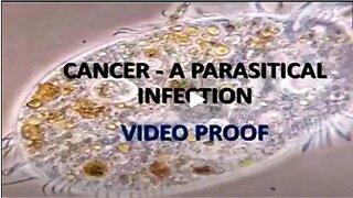 CANCER IS PARASITES!!! | AND THE CURES ARE EVERYWHERE 🔥