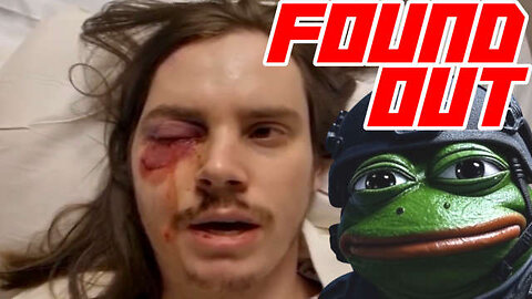 No Kings "Protestor" Gets Rubber Bullet to Eye