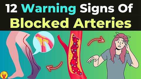 12 Symptoms Of Clogged Arteries You Must Not Overlook - Hidden Warning Signs of Arterial Blockage | VJ13