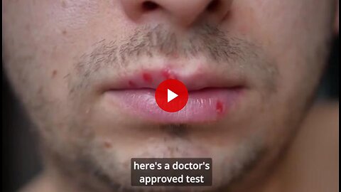 How to stop herpes in its tracks and regain your freedom!