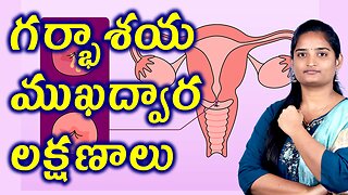 గర్భాశయ ముఖద్వార లక్షణాలు Signs & Symptoms Of Cervicitis Infection Homeopathy Treatment Medicine
