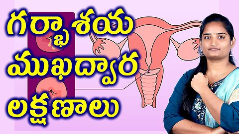 గర్భాశయ ముఖద్వార లక్షణాలు Signs & Symptoms Of Cervicitis Infection Homeopathy Treatment Medicine