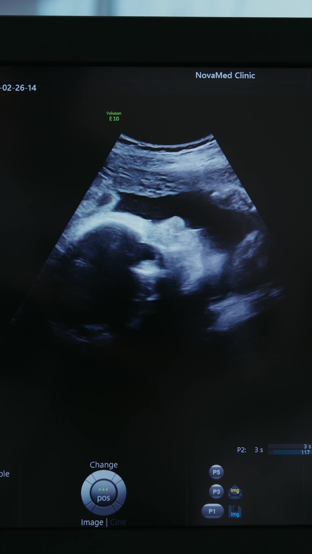 Not a Mistake! You were Made! - Psalm 139 #jesus #motivation #scripturereading