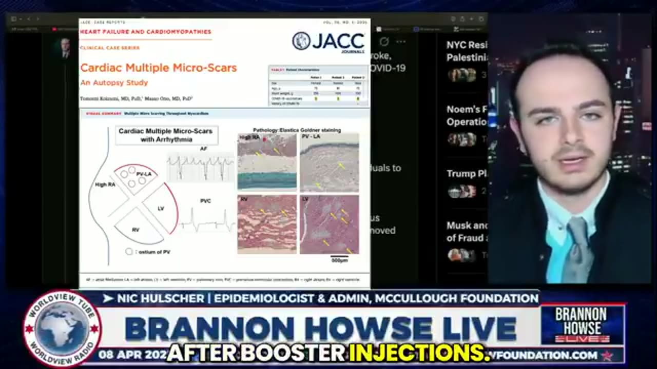 Study of 86 Million: Risk of Heart Attack, Stroke Surges with Every Covid 'Vaccine' Dose