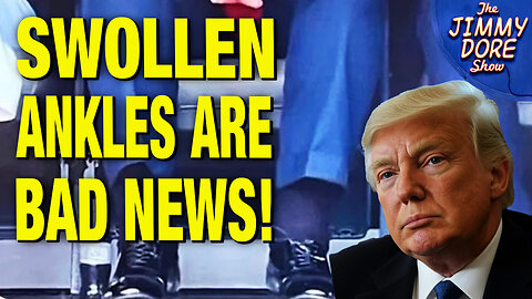 THIS Is How Trump Can Fix His Chronic Venous Insufficiency! w/ Kim Bright