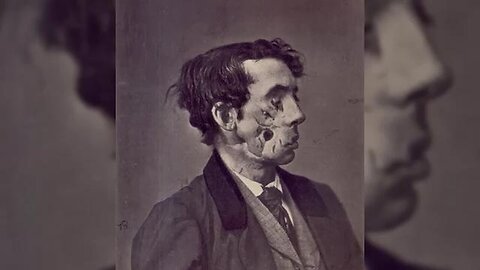 "Shiloh's Bloody Battle: The Stark Reality of Civil War's Brutality Unveiled"