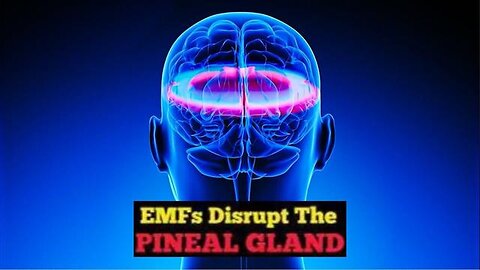 "Understanding How EMF Exposure Disrupts Pineal Function - Insights by KILLUMINATI13420"