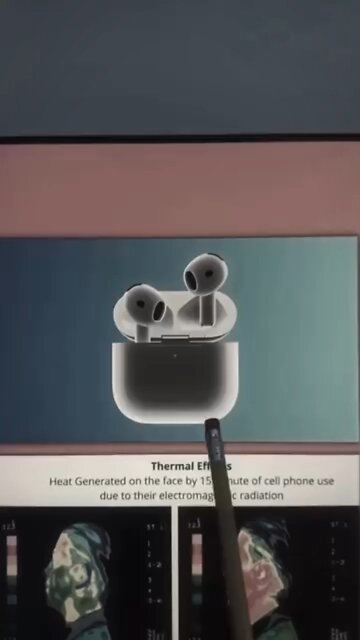 I STOPPED WEARING AIRPODS… & HERE’S WHY ⚠️👁️