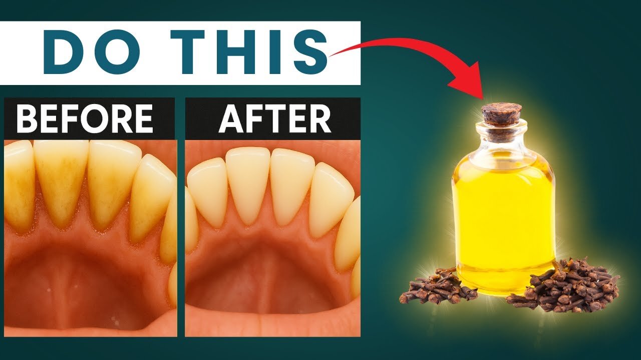 Whiten Teeth & Remove Plaque Naturally in Minutes! | 5 Powerful Home Remedies