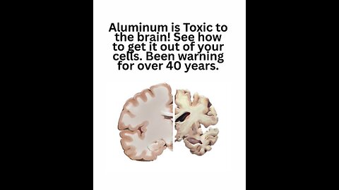Aluminum is Toxic to the brain! See how to get it out of your cells. Been warning for over 40 years.