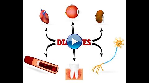 Shocking Study Reveals the Real Cause of Diabetes (Not Sugar)