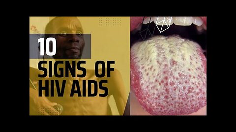 Unveiling HIV's Warning Signs"