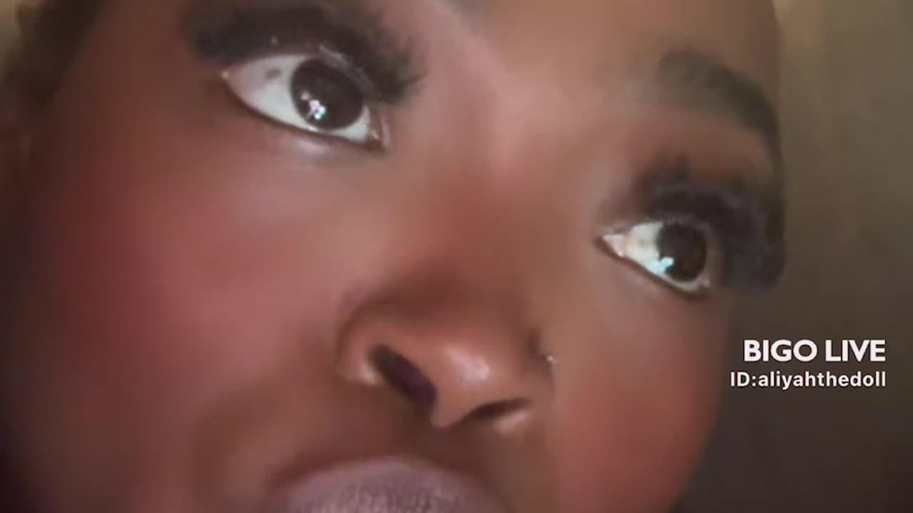 LIYAH GOES LIVE WITH BOIL ON HER LIP SAYS SHE HAS TO GET A SHOT!!