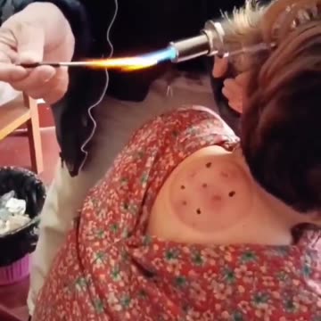 What kind of treatment is this?