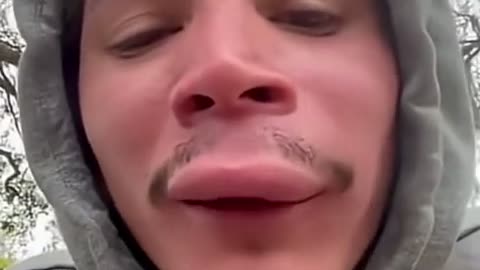 😱🐝 Lip vs. Wasp... And the Wasp Won! | FunFM